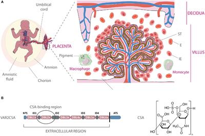 VAR2CSA-Mediated Host Defense Evasion of Plasmodium falciparum Infected Erythrocytes in Placental Malaria